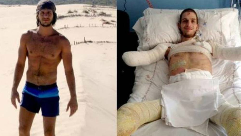 Tras diagnóstico erróneo, joven pierde las extremidades en España