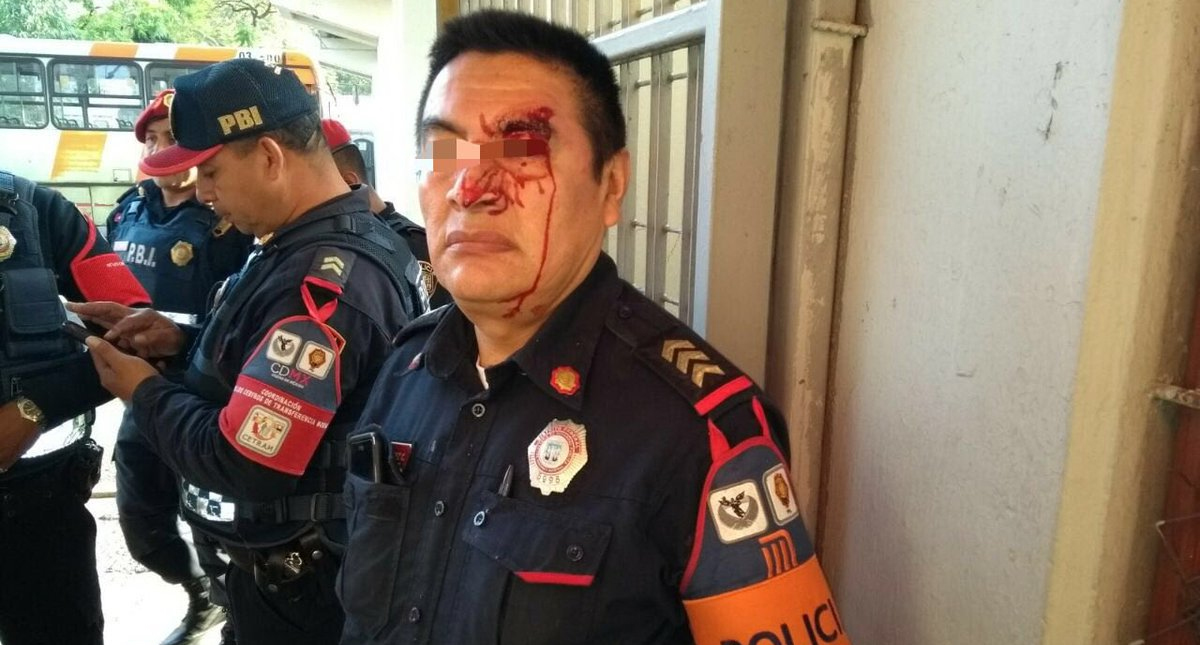 Joven en silla de ruedas golpea a policía en Taxqueña - joven-silla-de-ruedas-golpea-policia-taxquena-2