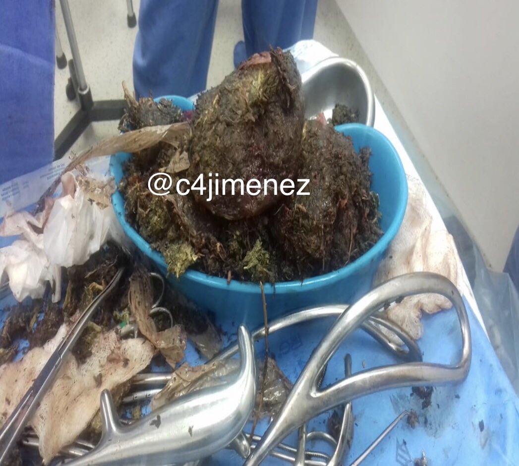 Mujer finge embarazo, pero ocultaba mariguana en el vientre - mujer-mariguana-oculta-hospital-3