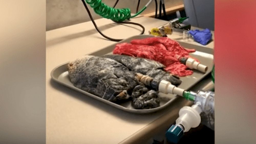 #Video La diferencia entre unos pulmones sanos y de fumador