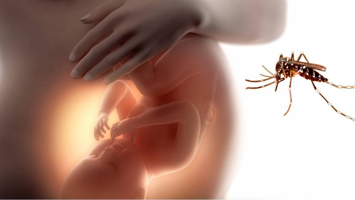 Virus del zika afectó principalmente a embarazadas