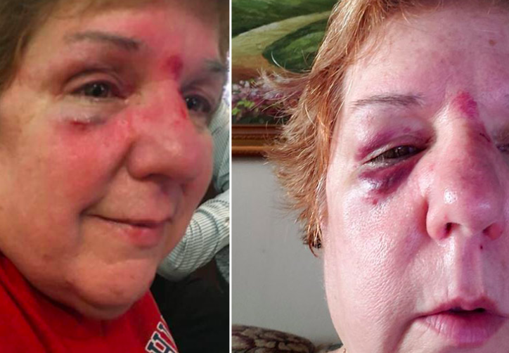 Mascota de los Philies lesiona a mujer con hot dog - captura-de-pantalla-2018-06-21-a-las-161728