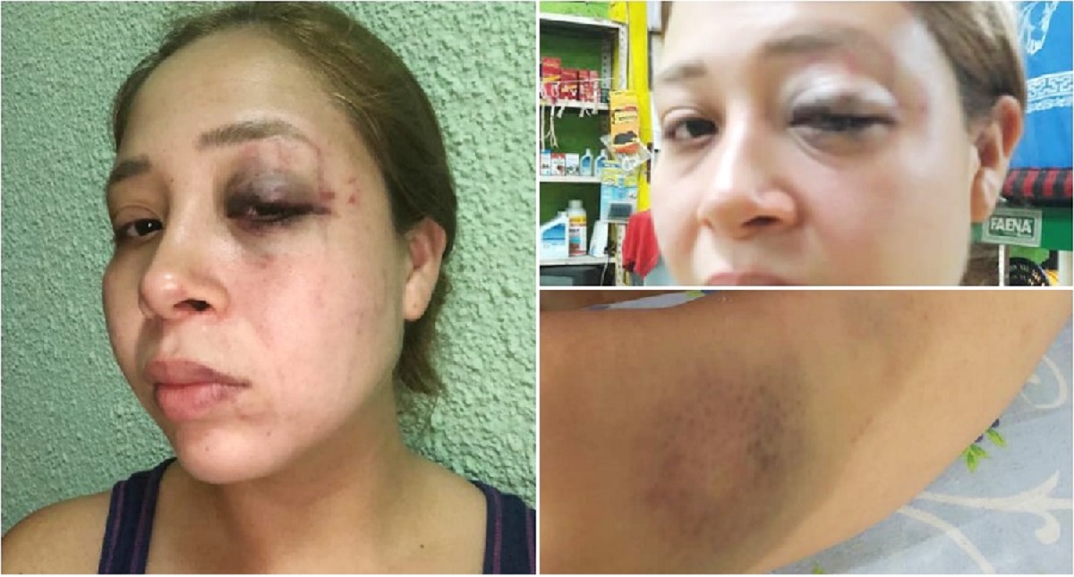 Dan licencia a edil golpeador para que enfrente cargos sin fuero - dan-licencia-a-edil-golpeador-de-chiapas-para-que-enfrente-cargos-sin-fuero