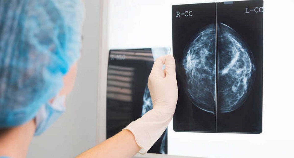 Advierten por relación entre productos de soya y el cáncer de mama