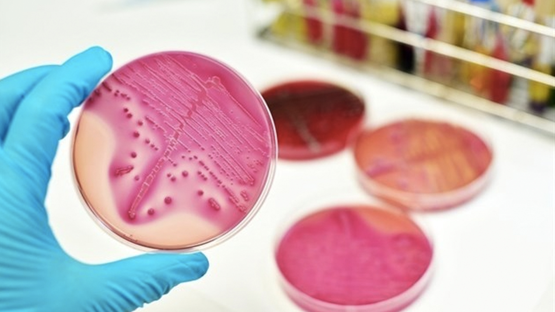 Aumentan casos de cáncer en Europa pero disminuyen las muertes - enfermedades