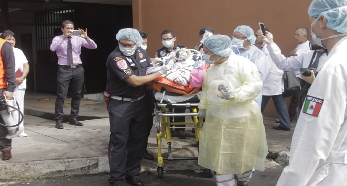 Muere víctima del Volcán de Fuego atendida en México - muere-victima-del-volcan-de-fuego-atendida-en-mexico