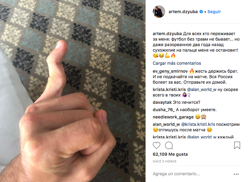 Dzyuba muestra la lesión en su mano durante el juego contra España - captura-de-pantalla-2018-07-05-a-las-114248