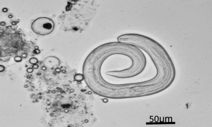 Madre e hijo contraen parásito asociado a ratas por comer ciempiés - cienpiesint