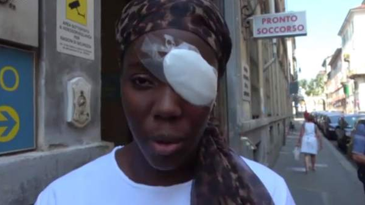 Lesionan a atleta durante ataque racista en Italia