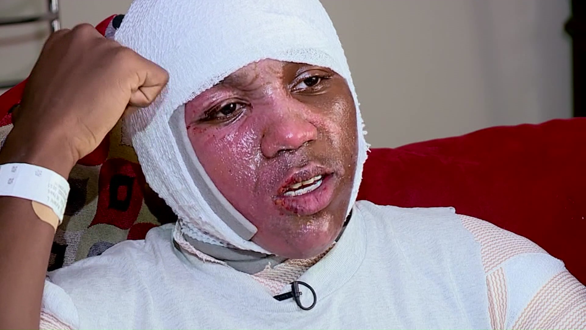 Joven sufre quemaduras por el ‘Hot Water Challenge’