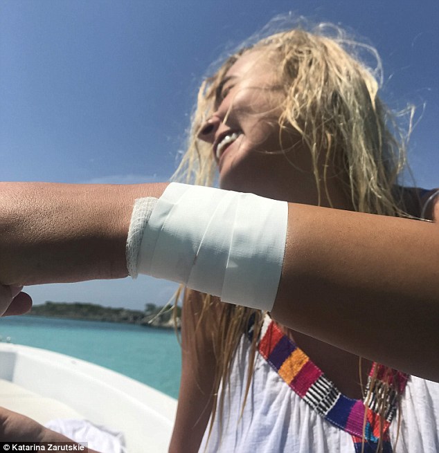 Tiburón nodriza ataca a modelo de Instagram en las Bahamas - modelo-instagram-ataque-tiburones-5