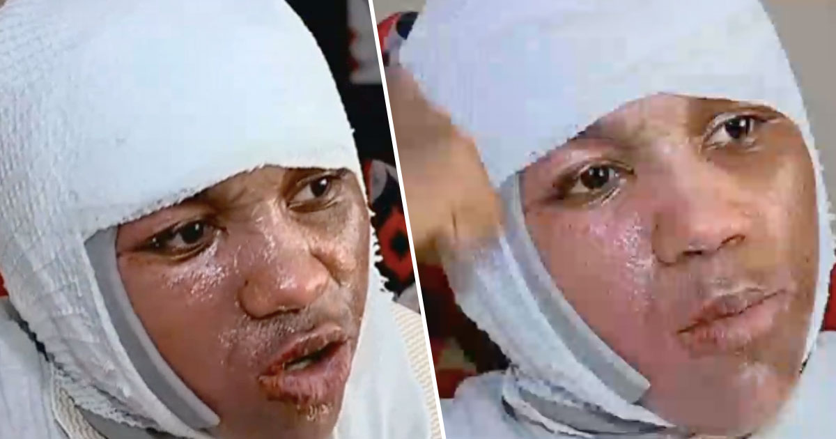 Joven sufre quemaduras por el 'Hot Water Challenge' - nino-quemaduras