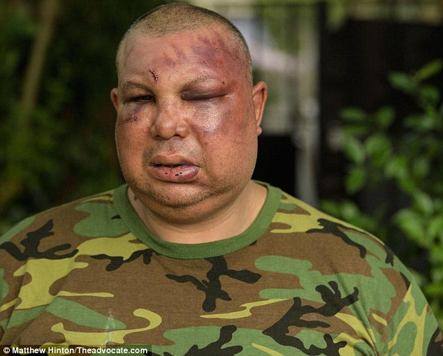 Despiden a policías de EE.UU. que golpearon a hombre por parecer latino - policiasgolpeadoresint2