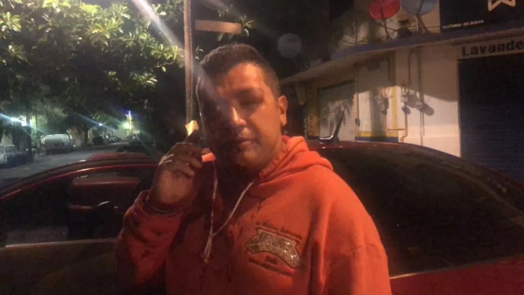 Agreden a fotógrafo durante operativo en vecindario de la Doctores