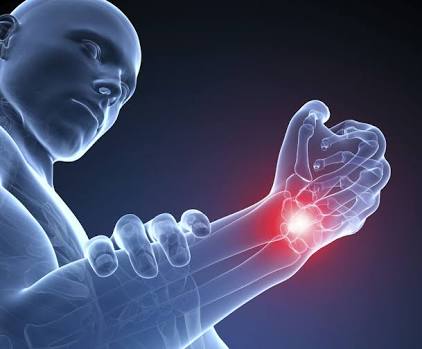 ¿Qué es el Síndrome del Túnel Carpiano? - tunel-carpiano-3