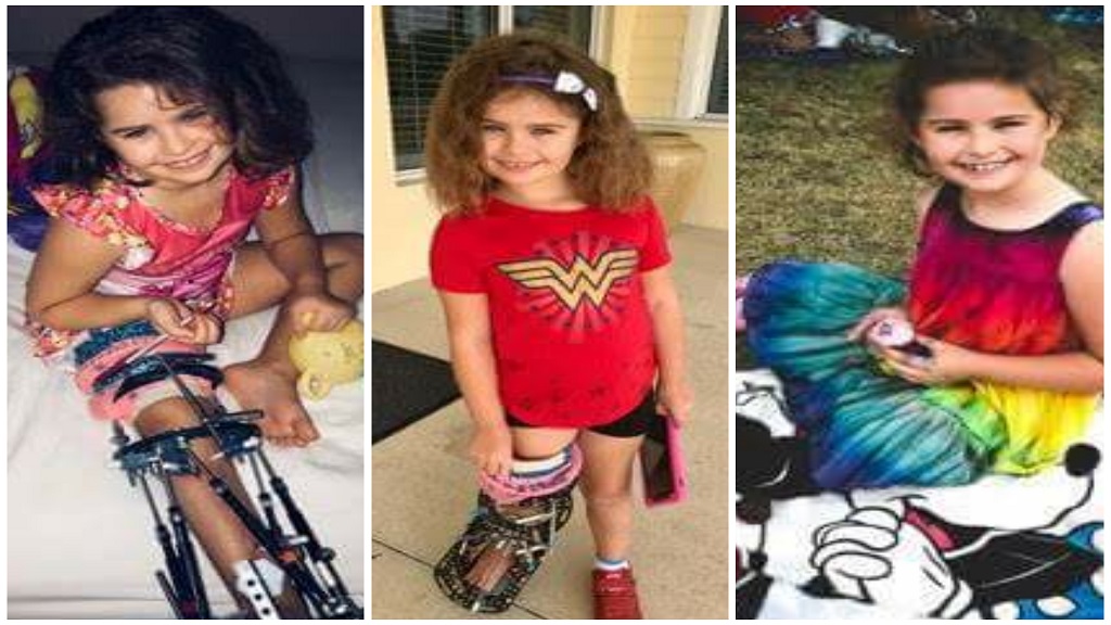 Niña con discapacidad en la pierna termina carrera de cinco km - aynslie