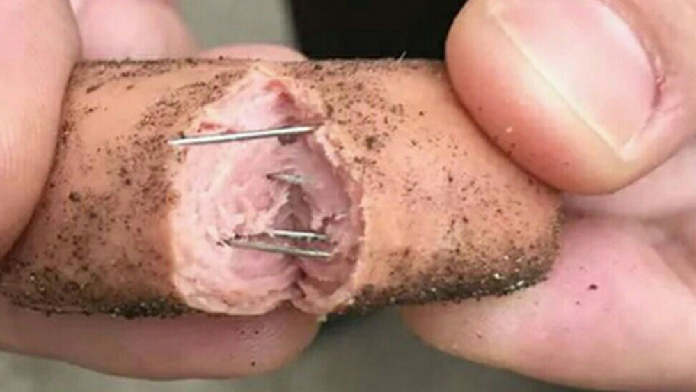 Alertan por aparición de salchichas con clavos en España