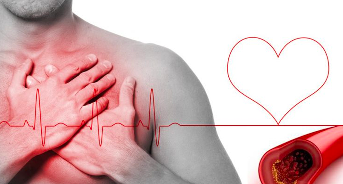 El 43 por ciento de los mexicanos adultos sufren de colesterol alto