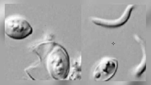 Alertan en EE.UU. por hallazgo de bacteria en ensaladas y wraps - cyclospora-alimentos