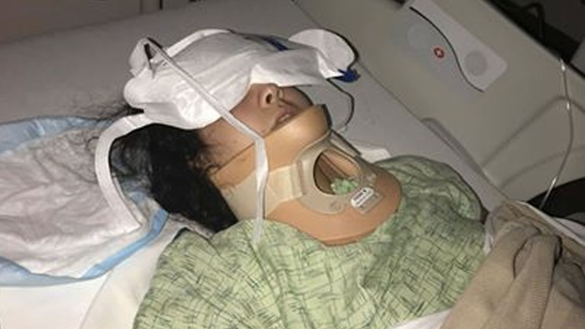 Joven sufre derrame cerebral al intentar el “KikiChallenge”