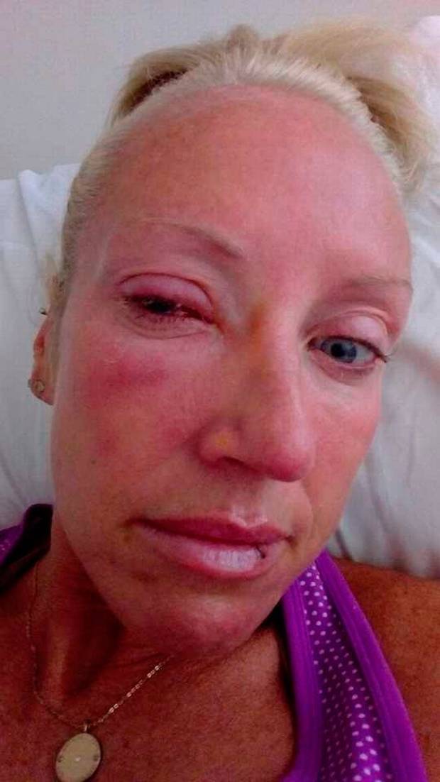 Mujer pierde la vista por bañarse con los lentes de contacto puestos - download-3