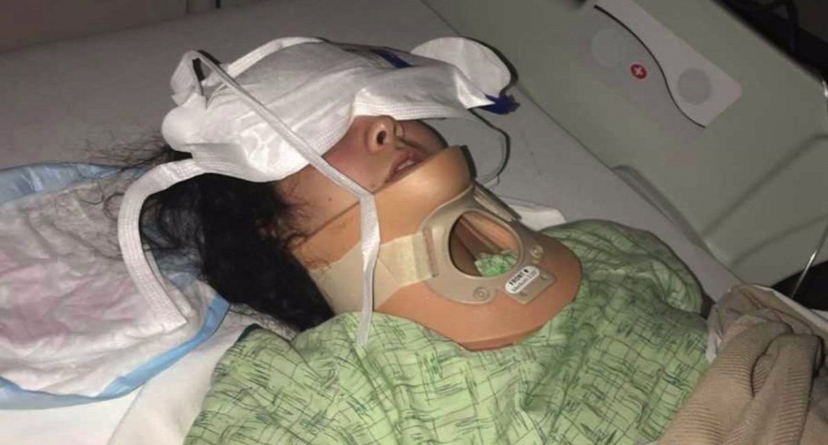 Joven debe aprender a caminar de nuevo tras accidente por Kiki Challenge - joven-debe-aprender-a-caminar-de-nuevo-tras-accidente-por-kiki-challenge