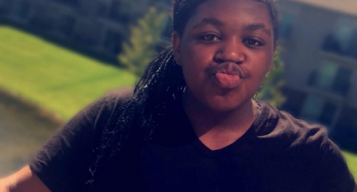 Niña se quema de las rodillas a la cabeza por reto viral - timiyah-landers