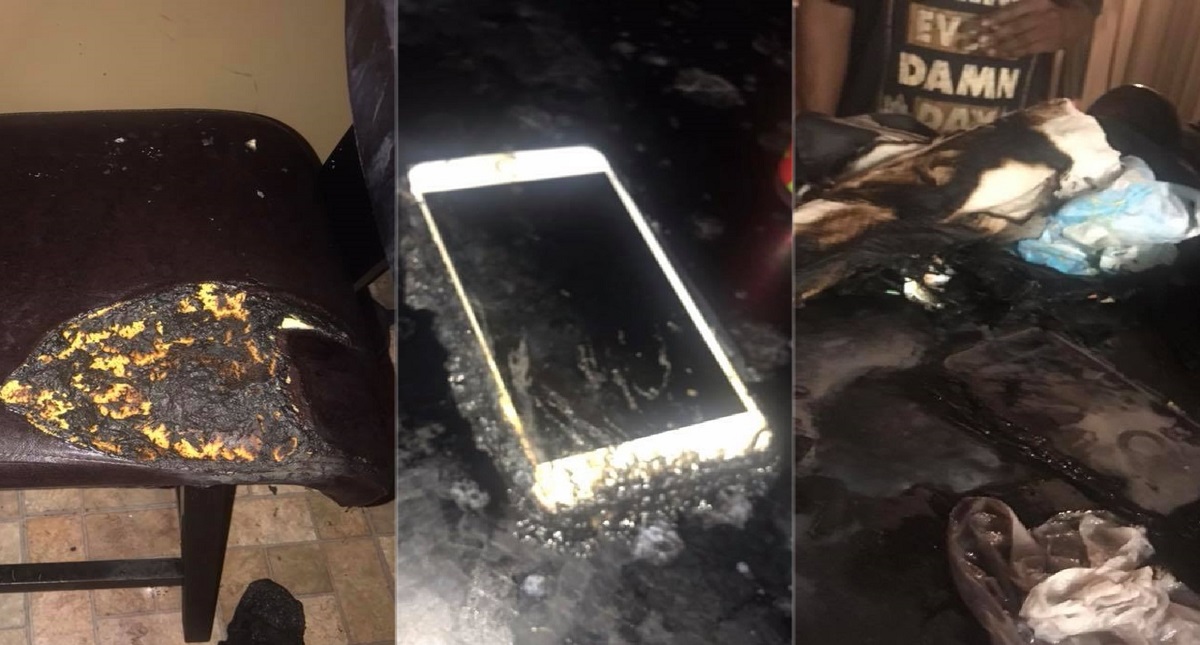 Niña se quema de las rodillas a la cabeza por reto viral - timiyah