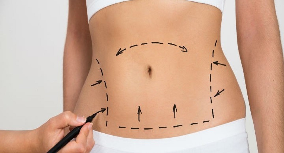 Alerta Cofepris por clínicas de cirugía estética “patito”