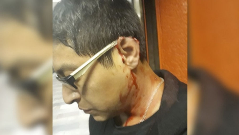 Hombre le arranca pedazo de oreja a otro durante riña en el Metro