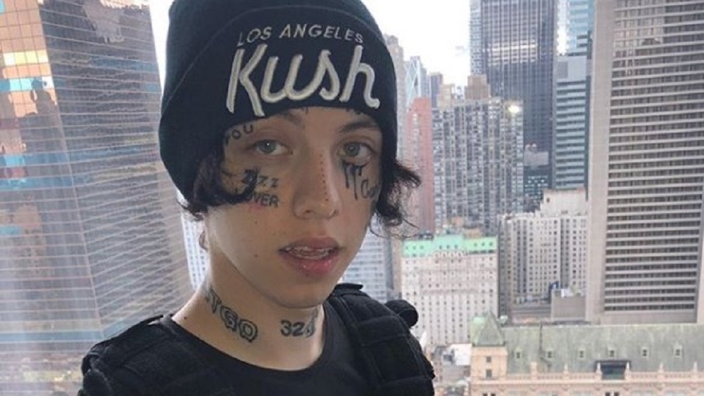 Hospitalizan a rapero por comer demasiados Cheetos picantes