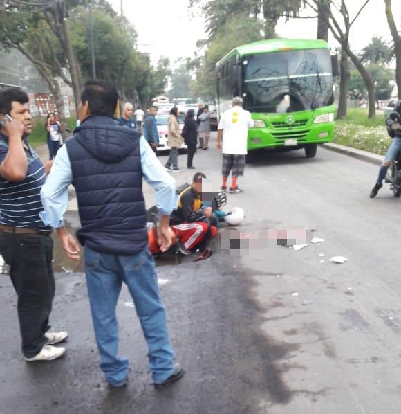 Motociclista cae a bache y su hijo muere aplastado por camión - menor-atropellado-periferico
