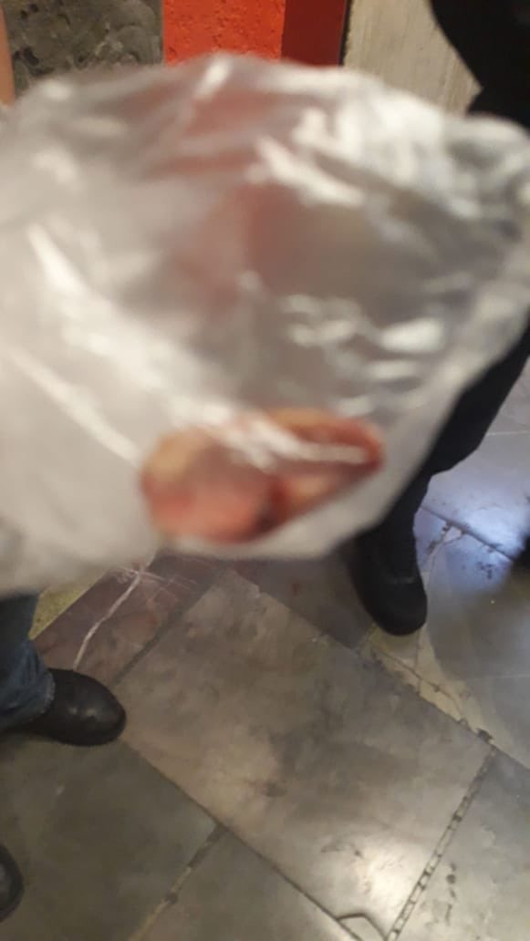 Hombre le arranca pedazo de oreja a otro durante riña en el Metro - oreja-metro1