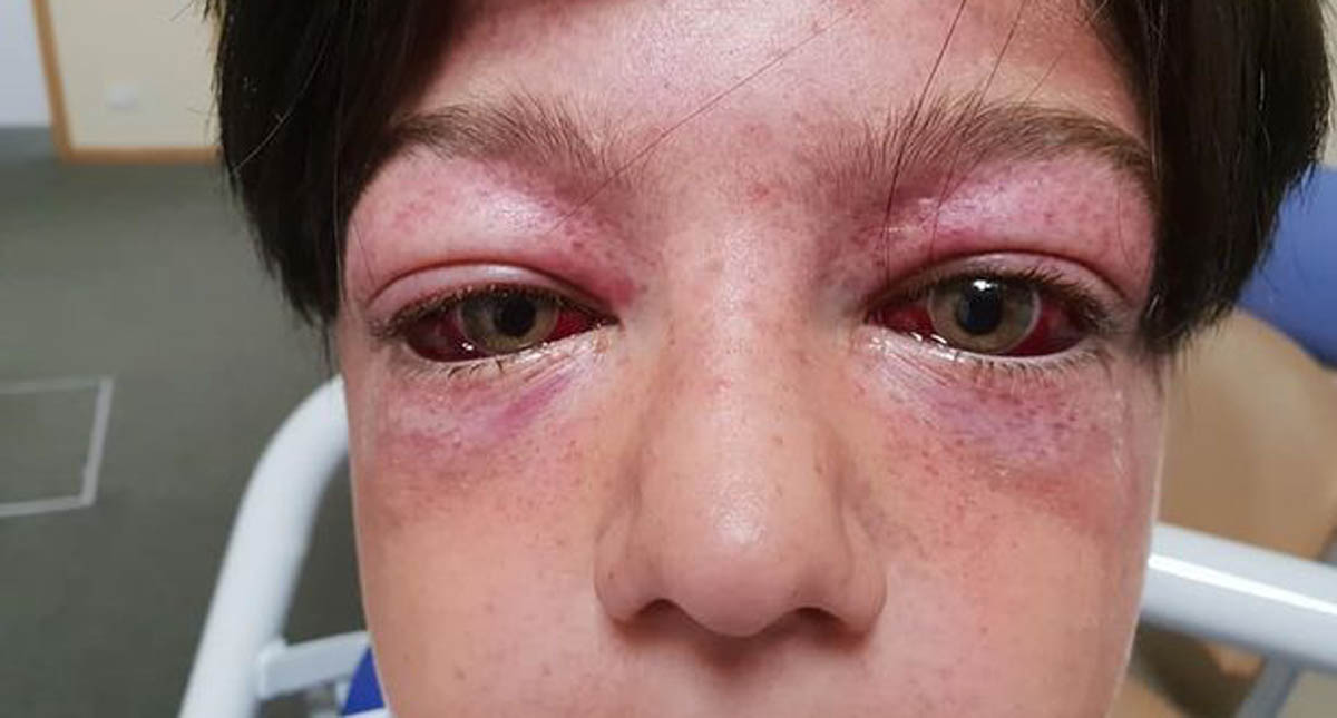 #Video Reto en carrusel deja a niño de 11 gravemente herido