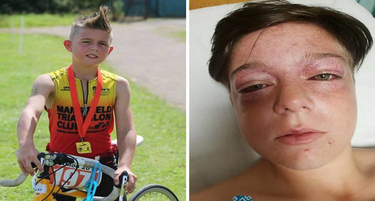 #Video Reto en carrusel deja a niño de 11 gravemente herido - tyler-broome