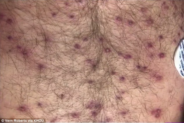 Hombre recibe 600 picaduras de abejas asesinas en Texas - vern-roberts-abejas-asesinas-2