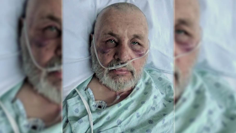 Hombre recibe 600 picaduras de abejas asesinas en Texas