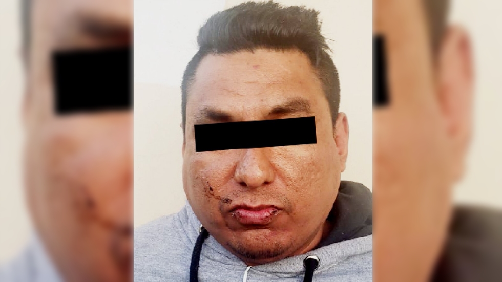 Tapa su brazalete electrónico con aluminio para asaltar en Ecatepec