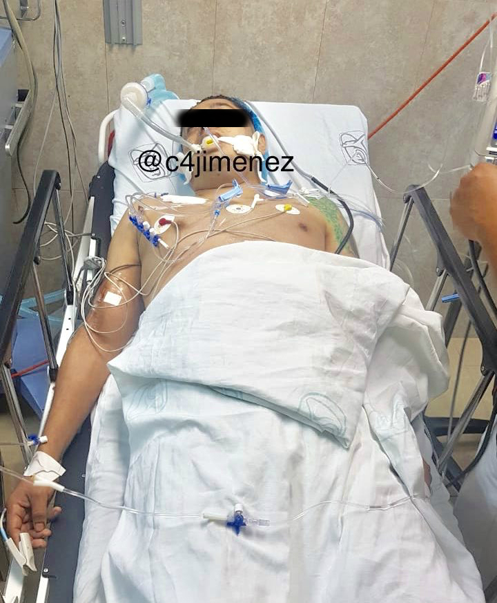 Atacante de casa de Norberto Rivera se hizo pasar por mensajero - atacante-norberto-rivera