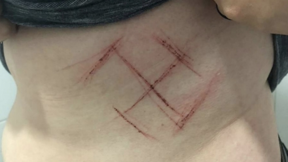 Brasileña "tallada" con esvástica se automutiló: policía - esvastica-brasil-joven