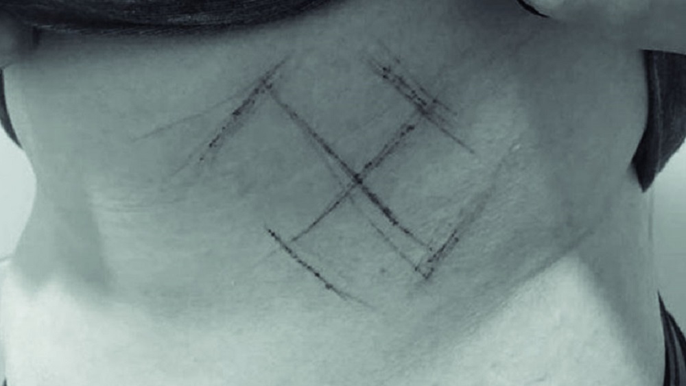 Seguidores marcan con navaja a joven por estar contra Bolsonaro