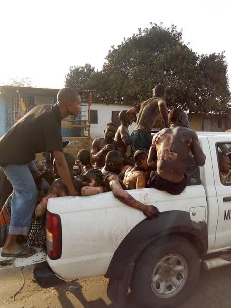 Mueren 50 personas en accidente de tránsito en el Congo - lesionados-camion-cisterna-congo