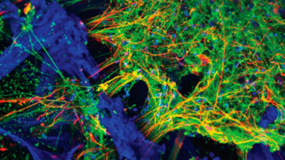 Afirman científicos estar muy cerca de crear cerebros