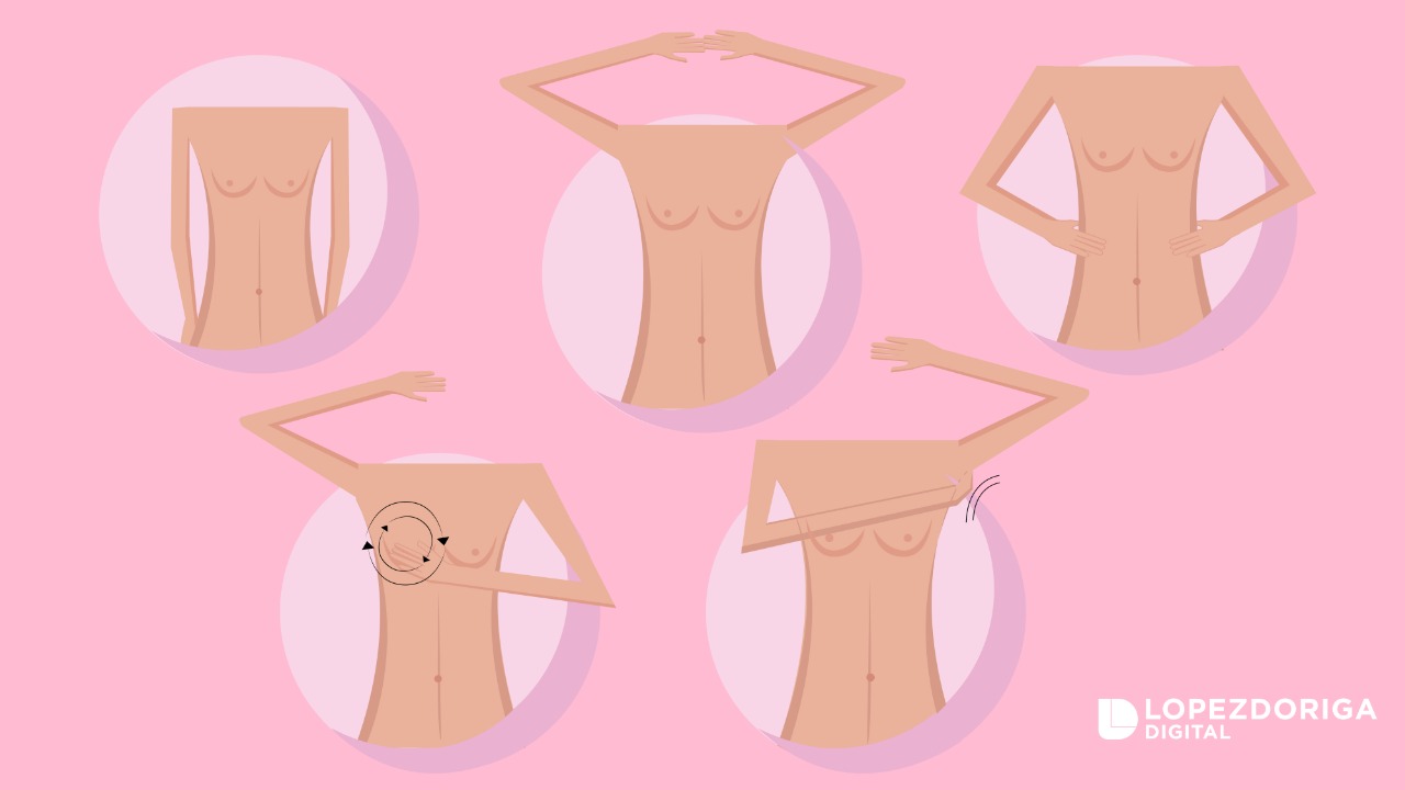 Prevención, vital en la lucha contra el cáncer de mama Prevención, vital en la lucha contra el cáncer de mama