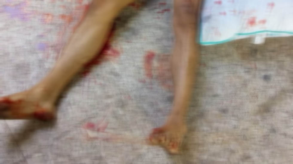 Adolescente mata a su pareja en la Gustavo A. Madero - el-joven-de-19-anos-fue-muerto-con-un-arma-blanca