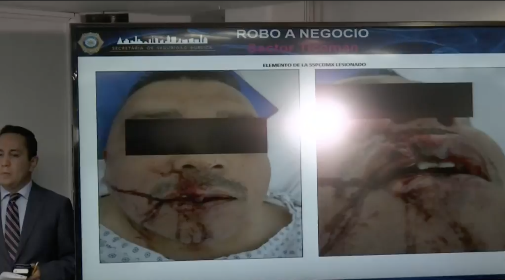 Mantienen bloqueo de la México-Pachuca; queman otra patrulla y hay saqueos - policia-herido-san-juanico-2