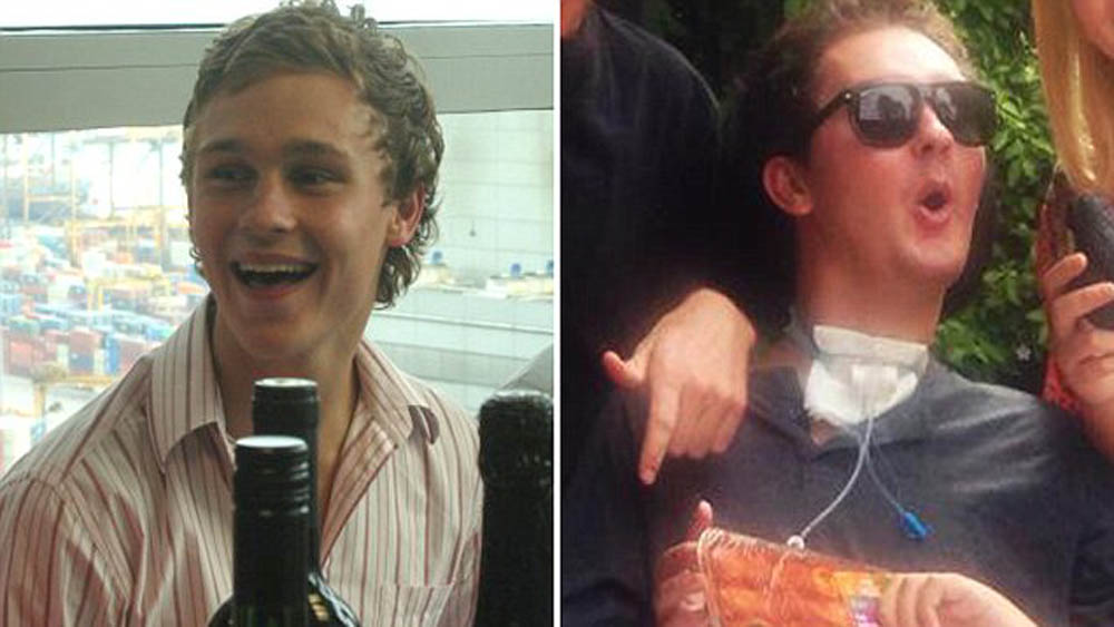 Muere jugador de rugby que quedó tetrapléjico por comer una babosa Muere jugador de rugby que quedó tetrapléjico por comer una babosa