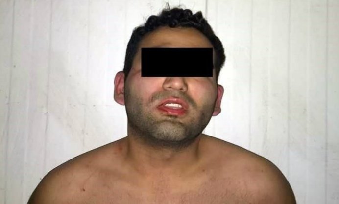 Detienen a hombre que condujo con un policía en el cofre de su auto - conductor-detenido