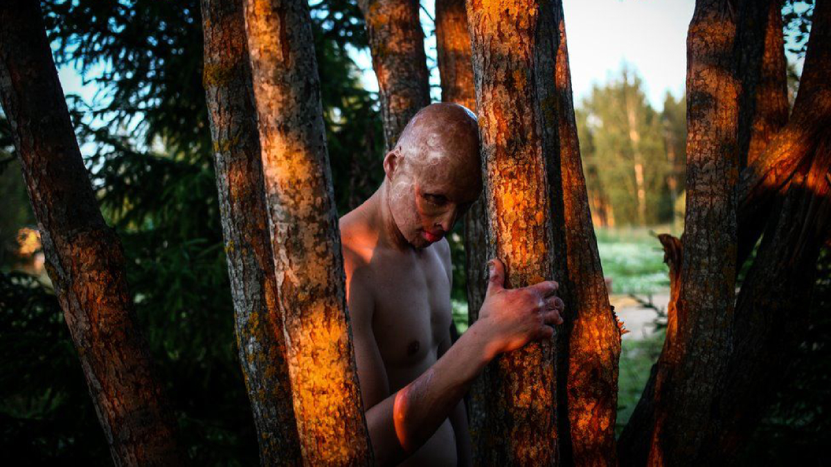 El niño que sobrevivió a ser metido en un horno por su padre