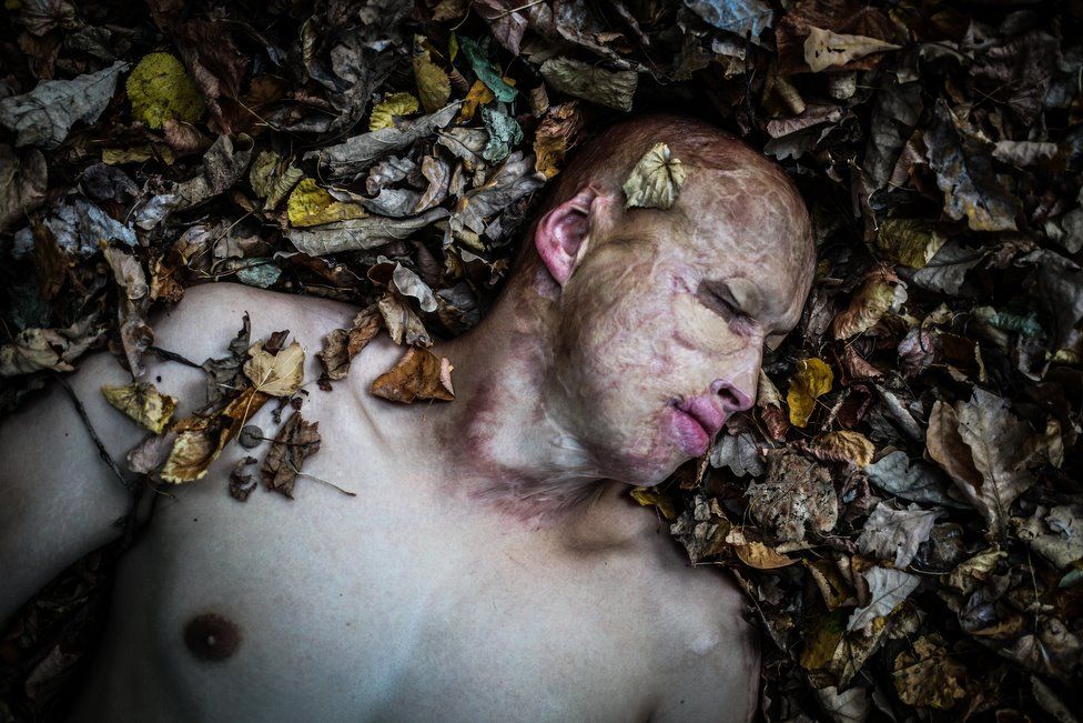 El niño que sobrevivió a ser metido en un horno por su padre - lyosha-joven-quemado-en-horno